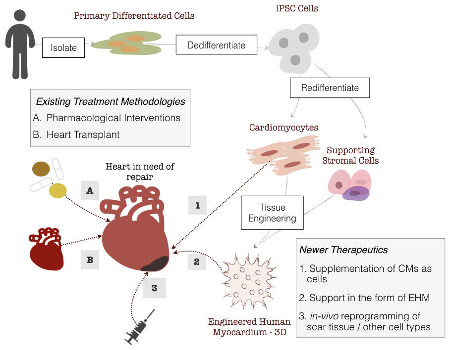 Delivery Strategies of iPSC-CMs and Treatment Options for Heart Failure. Production of EHMs start with isolating primary differentiated cells (e.g, fibroblasts) which are then dedifferentiated to iPSCs followed by redifferentiation to CMs and stromal cells, which are then combined in a collagen matrix forming the EHM.